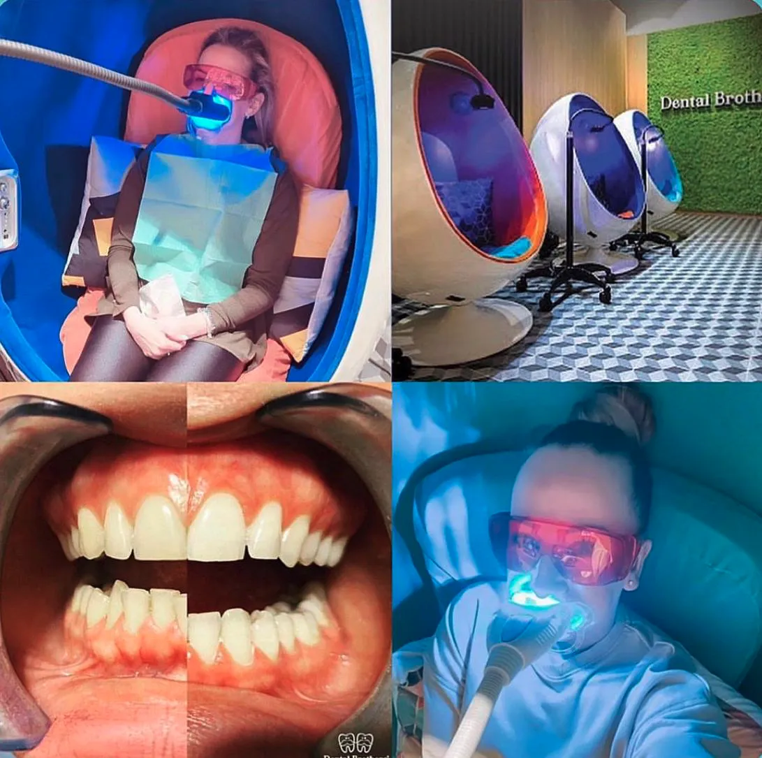 bielenie-zubov-dental-brothers-29