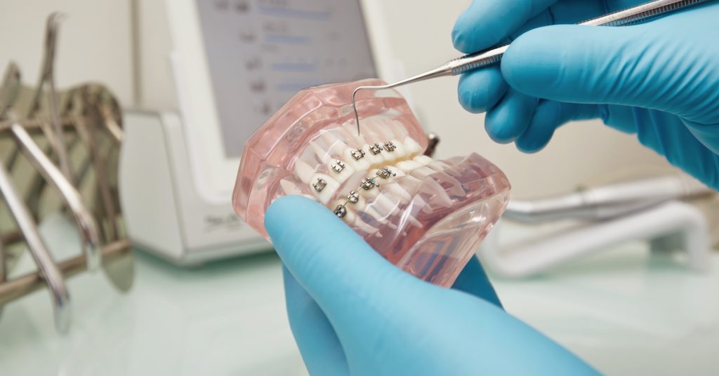 dentalna hygiena zubny strojček