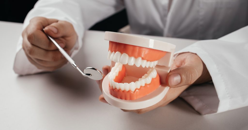 odstraňovanie škvŕn zo zubov