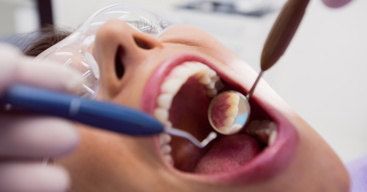 Dentálna hygiena pre paropacientov