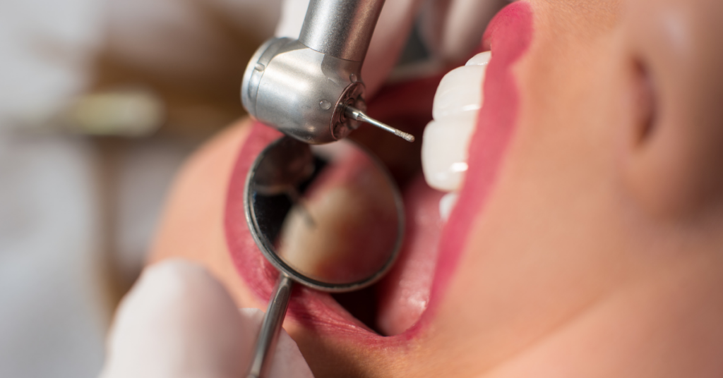 Dentálna hygiena s príspevkom od poisťovne